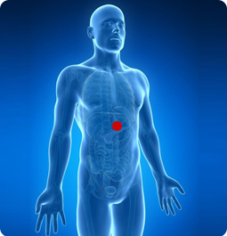 Epigastric Hernia