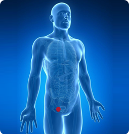 Recurrent Hernias